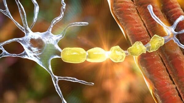 demyelination of neuron getty images