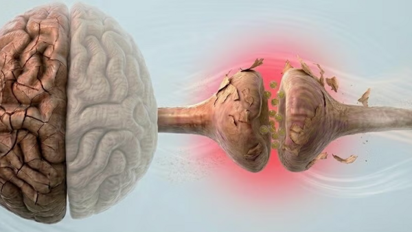 traumatic brain injury 